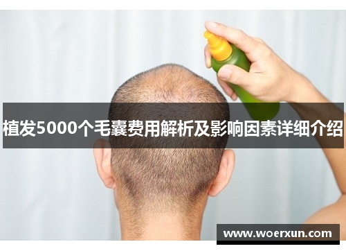 植发5000个毛囊费用解析及影响因素详细介绍 植发5000个毛囊费用解析及影响因素详细介绍